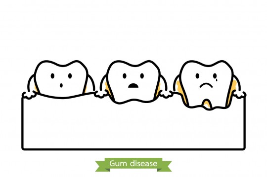 歯周病はなぜ起きる？原因と予防法を覚えよう